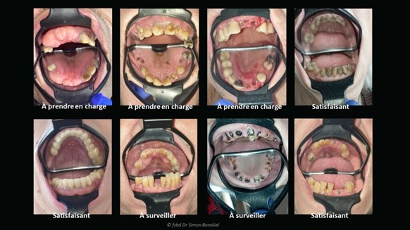 Images%20odontoscope%20Benoliel
