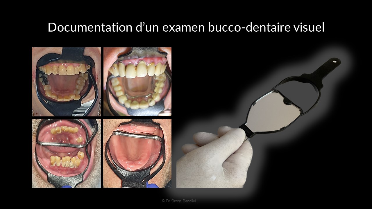 examen%20visuel%20bucco-dentaire