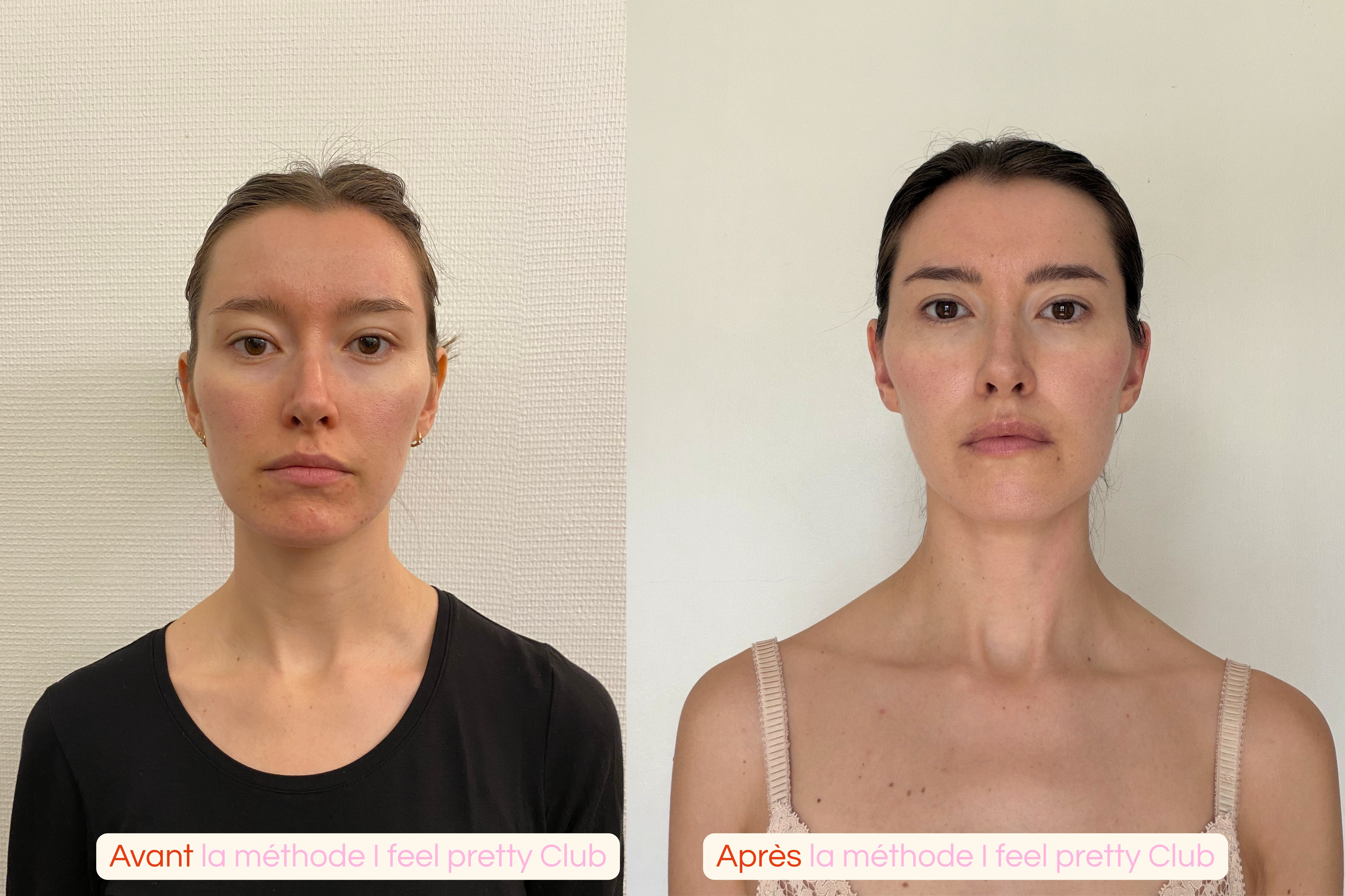 photos%20avant%20apr%C3%A8s3