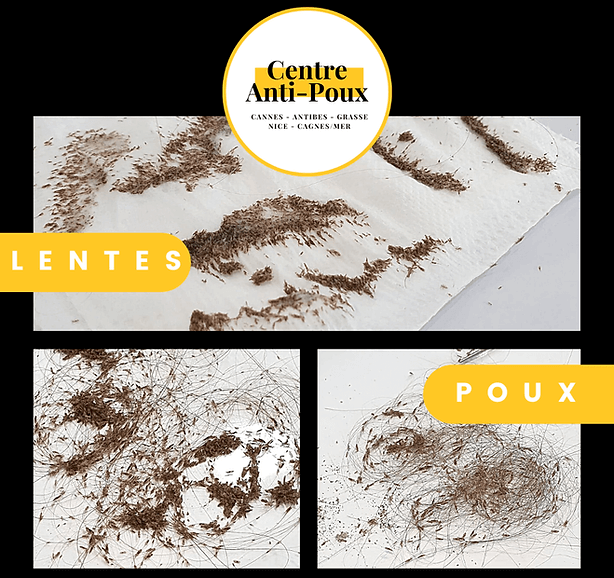 AvantApr%C3%A8s-et-PouxLentes-_4__1_