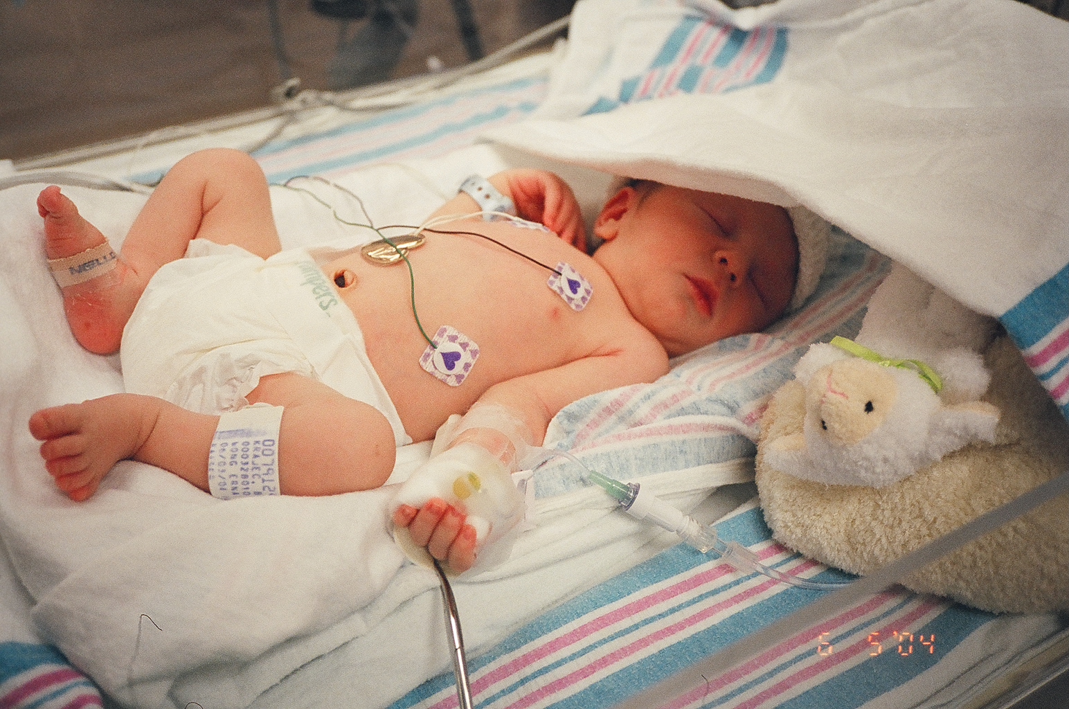 Baby%20Christofer%20in%20ICU%20Sleeping