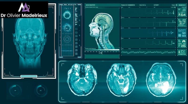 Préparateur Mental de Sandrine Martinet - Médaille d'or de Judo aux Jeux Paralympiques 2016 et mondiaux 2019