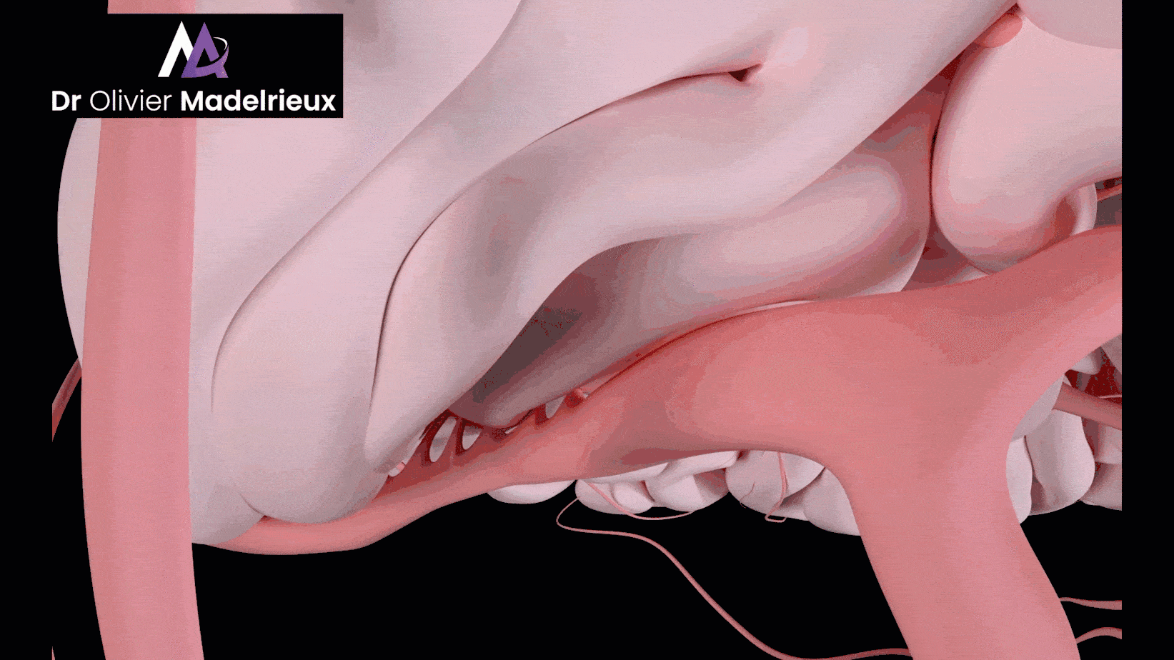 Préparateur Mental de Sandrine Martinet - Médaille d'or de Judo aux Jeux Paralympiques 2016 et mondiaux 2019