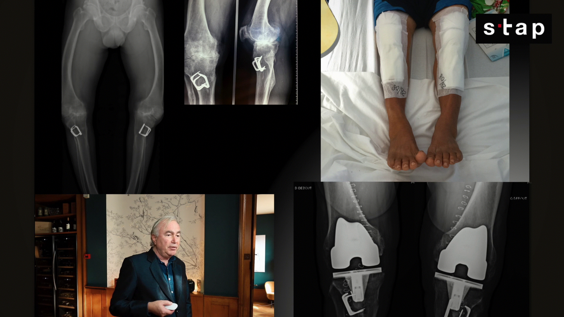 1_6%20Comment%20choisir%20exemple%20un%20patient%20